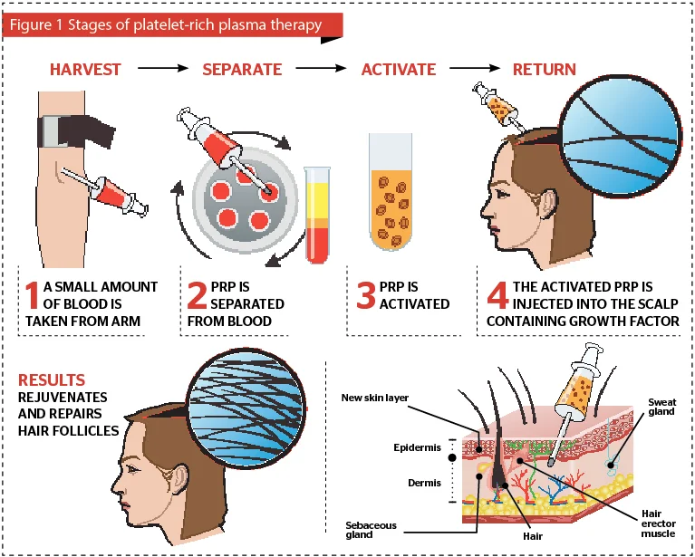 MANSON Hair Growth Factor PRP Tubes Scd Biotin 10ml