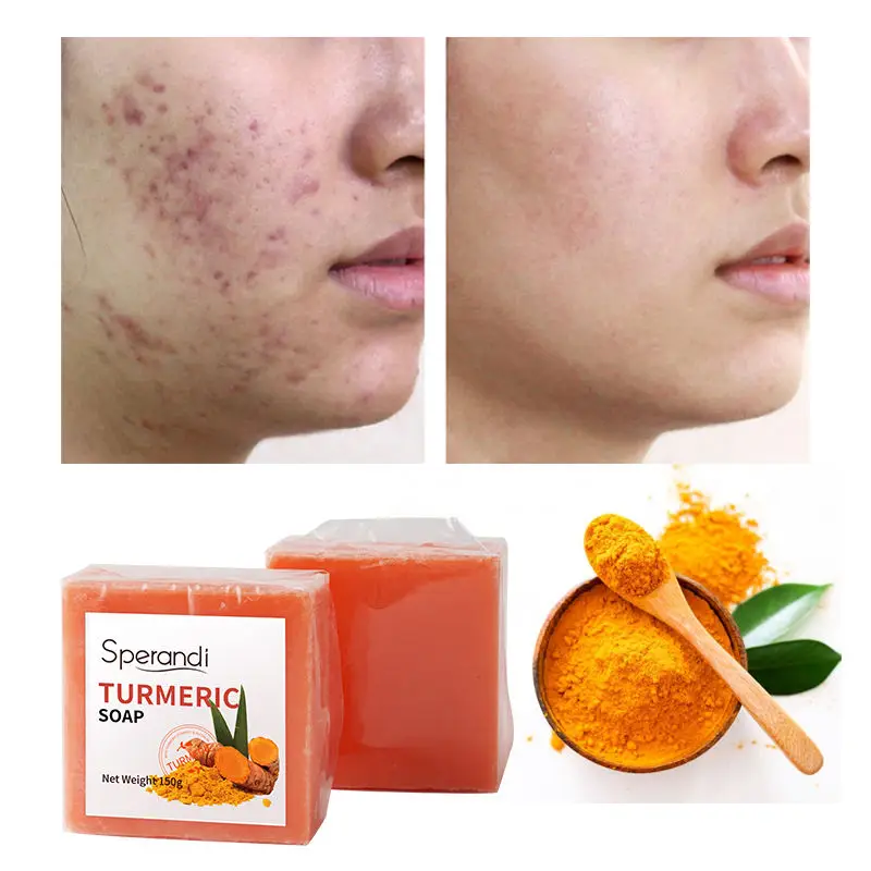 Factory Wholesale Private Label OEM Organic Whitening Anti-acne Skin Care Turmeric Handmade Bath Facial Soap 100g