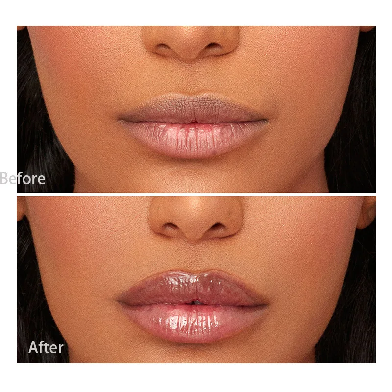 Abundant Lip Oil  Ginger Fade Lip Lines  Private Label Hydrating Lip Honey