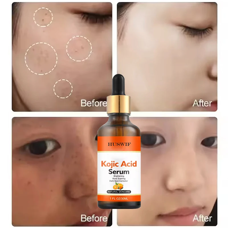 Private Label Kojic Acid Serum Dark Spot Corrector Lightening Whitening for Face & Body with Alpha Arbutin, Niacinamide