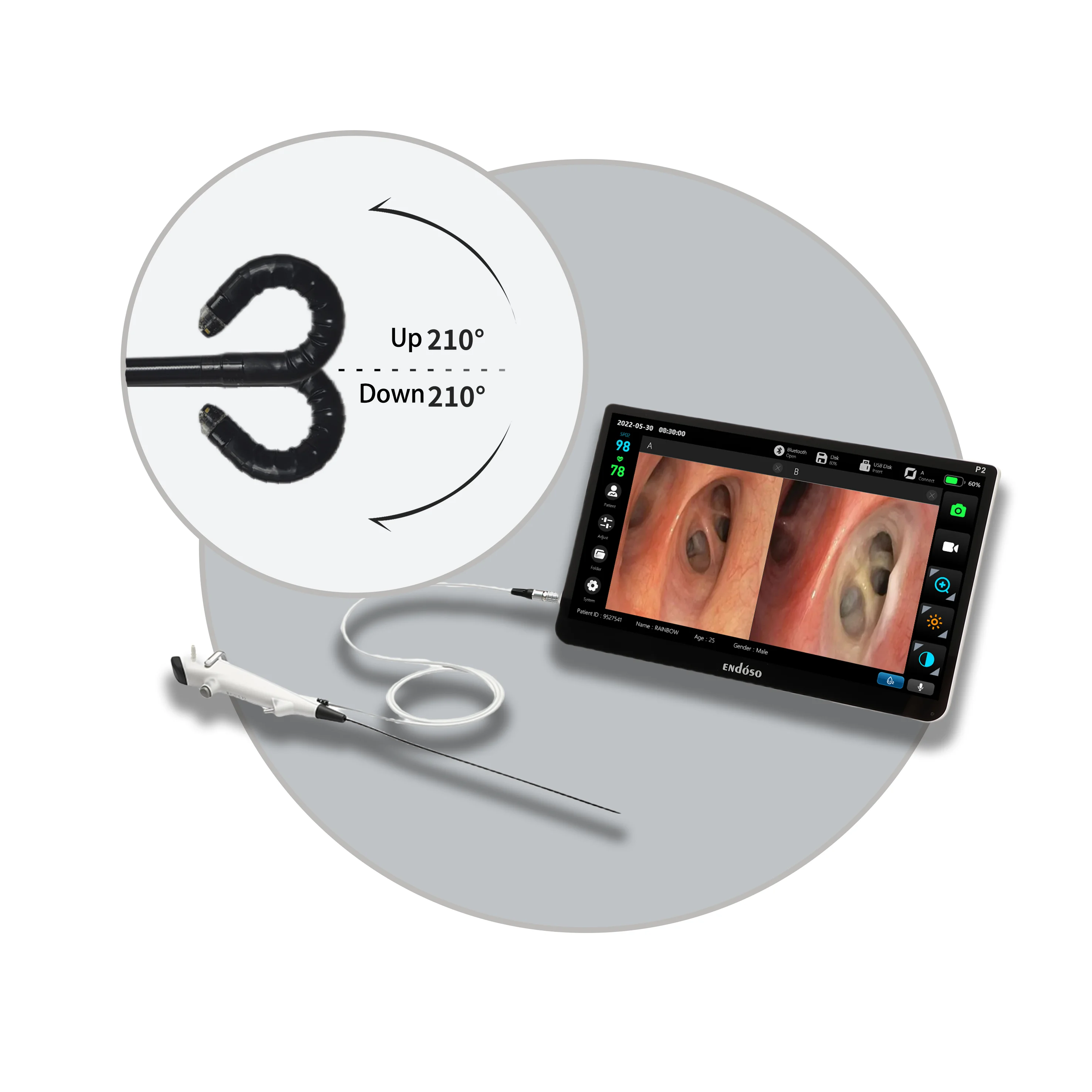 Supplier Hot Selling HD Endoscope Camera Digital Cystoscope USB Port Disposable Flexible Cystoscope with CE