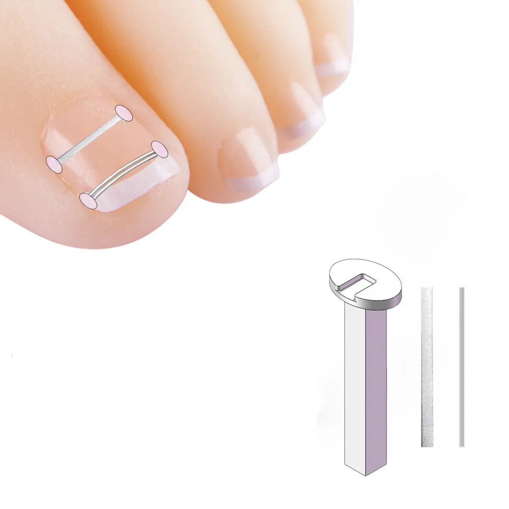 Feet Care Tools Foot Care Ingrown Nail Nickel titanium alloy nail groove embedded armor steel wire Ingrown Toenails Corrector