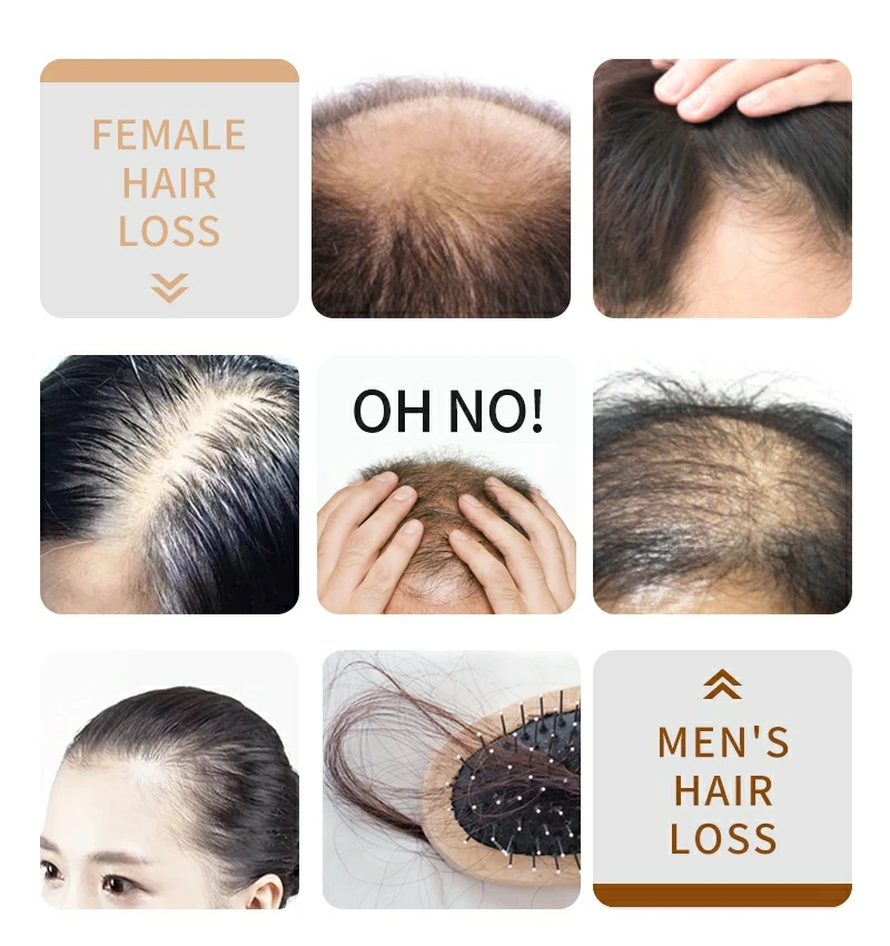 SEVICH ginger anti hair loss regrowth hair treatment shampoo