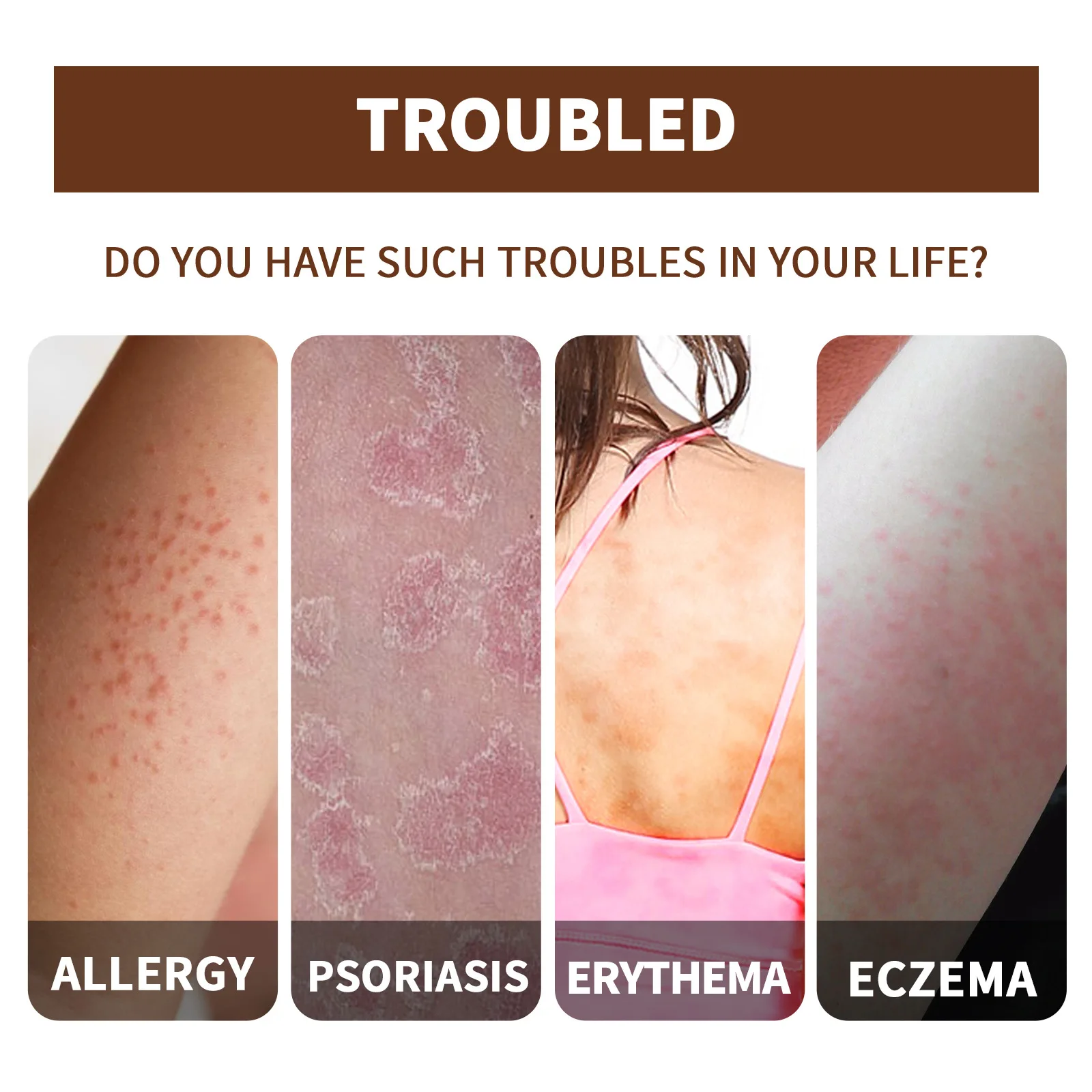 Eelhoe Private Label Skin Moss Repair Essential Oil Anti Itching Hand And Foot Skin Care Serum