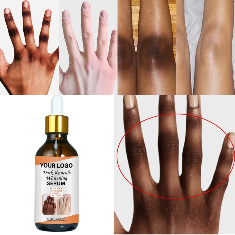 Фирменная Сыворотка для быстрого отбеливания суставов колена, сыворотка для удаления интенсивных пятен на коленях