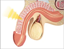 OEM ODM Shock Wave Therapy ED Extracorporeal Shockwave Therapy for Penis
