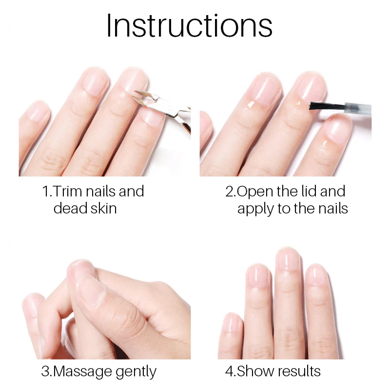 Best treatment nail fungus wholesale 30ml kills fungus restore and renews protects from reinfection purple nail fungus treatment