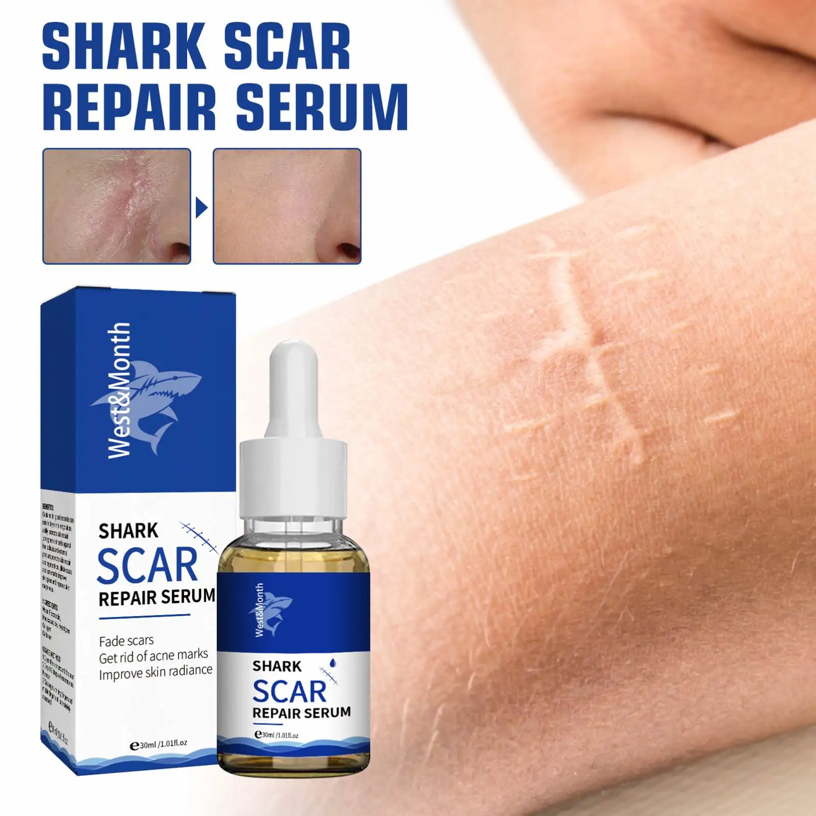 West Moon Wholesale Skin Care Scar Acne Mark Pimples Spots Repair Serum Shark Scar Treatment Oil Scar Removal Gel