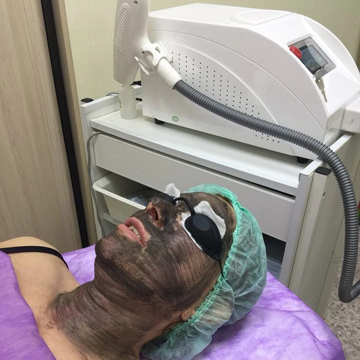 New technology mini whitening face laser portable q switched nd yag 1064 532nm tattoo removal laser device carbon peel