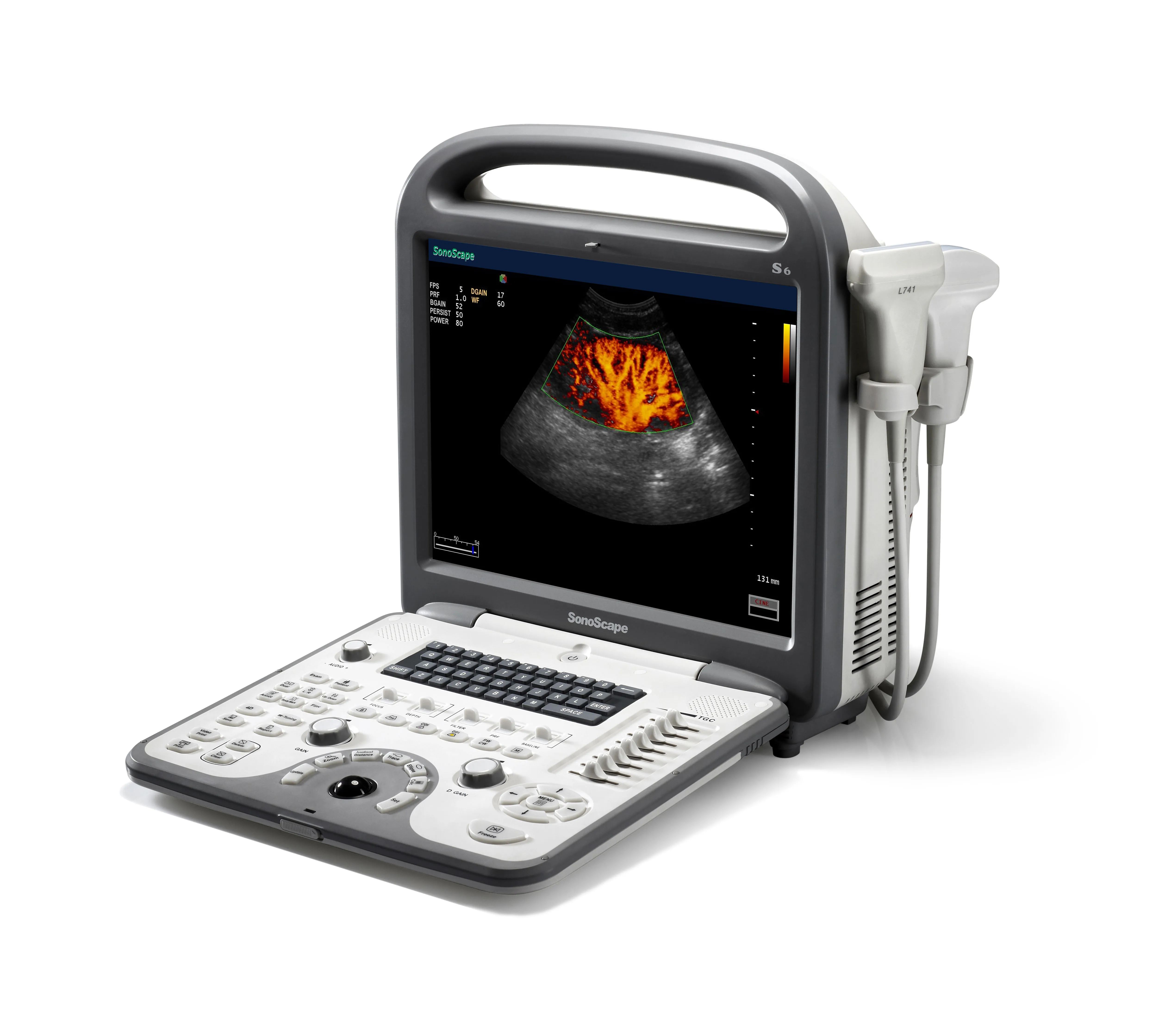 2021 Latest Wholesale Sonoscape 3D 4D Color Doppler Ultrasound Portable