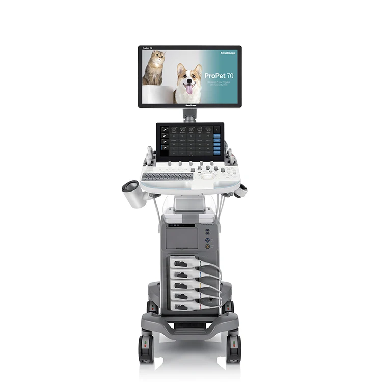 Sonoscape Propet 70 Hot Sale Smart Diagnostic Ultrasound Trolley Machine with Exceptional Capability