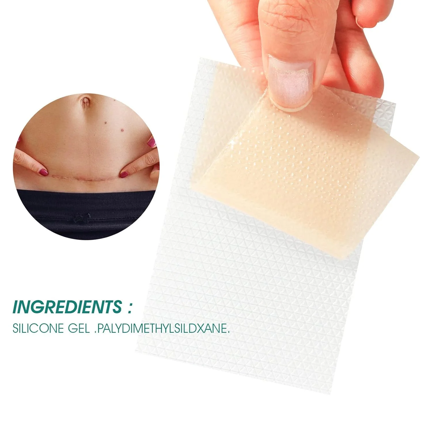 Silicone Gel Film Scar Sheets Soft Waterproof Adhesive Silicone Patch Scar Treatment Strips Removal Sheet