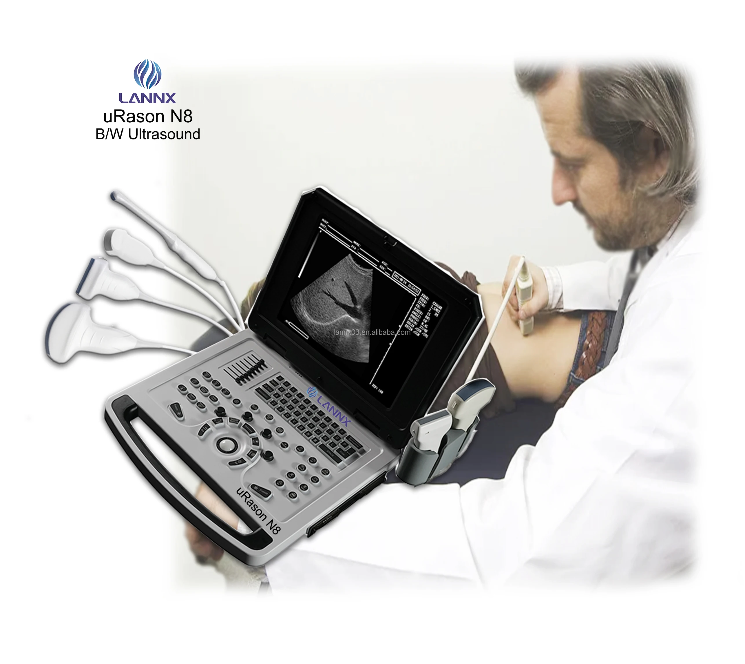 LANNX uRason N8 Hospital Electric ultrasonic Diagnostic Devices portable ultrasonic scanner black and white ultrasound machine