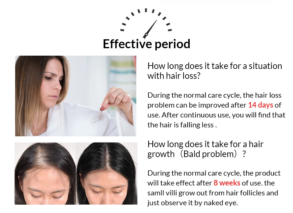 OMY LADY hair care growth shampoo liquid natural hair growth tonic for hair strong