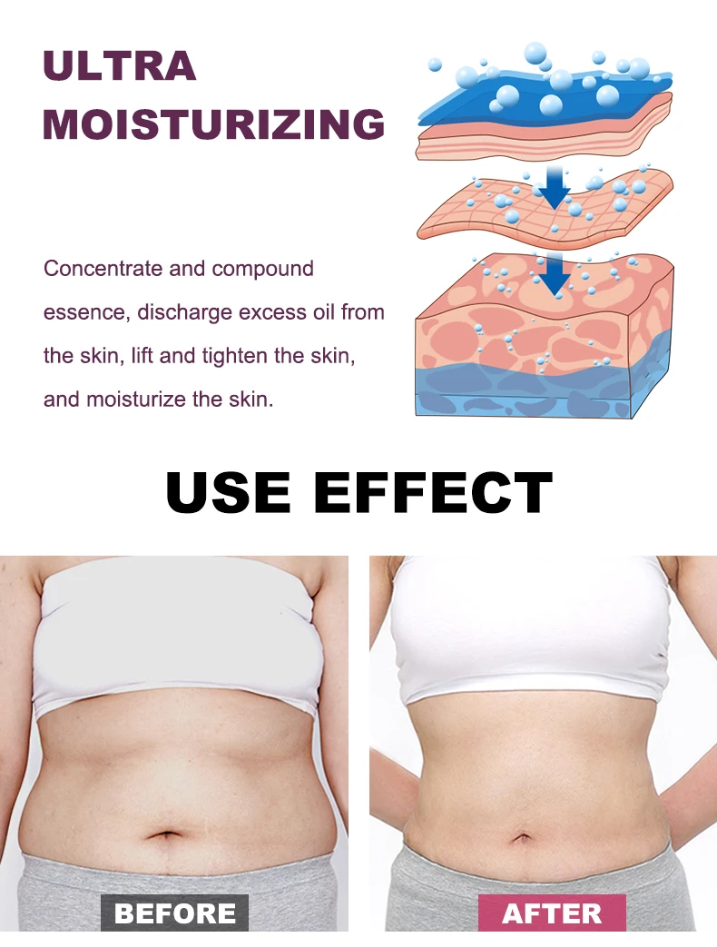 Free Sample  Private Label Fat Burning Slim Sweat Hot Gel Waist Firming Body Shaping Weight Loss Anti Cellulite Slimming Cream