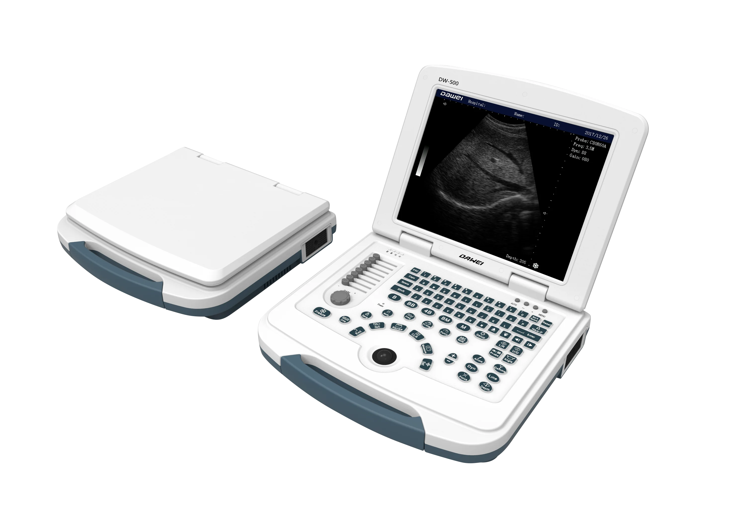 DW-580 low price portable ultrasound scanner & medical equipment