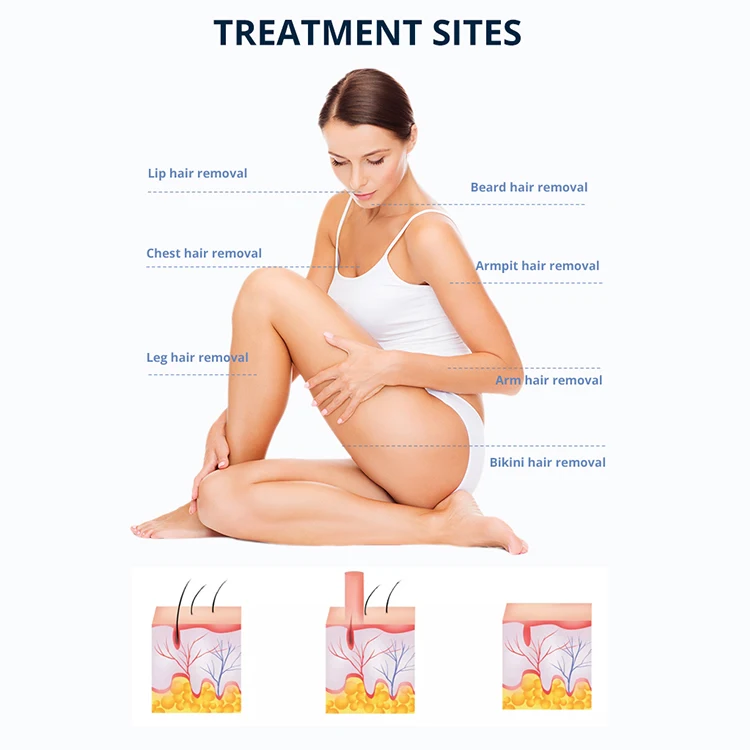 PZ LASER Hair Removal Machine Diode Laser 808nm Lightsheer Diode Ice Laser Hair Removal Germany