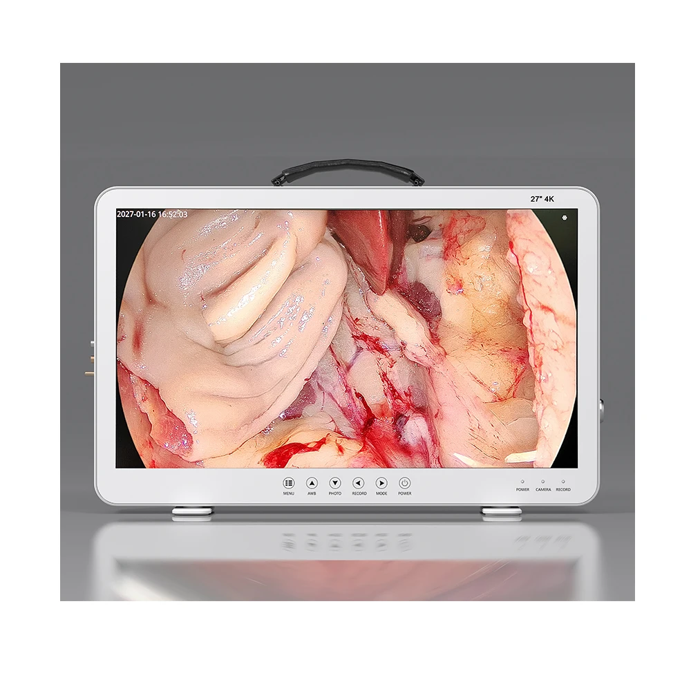 Medical 22inch 24inch 27inch 4 in one UHD/FHD 1080P Portable laparoscopy cystoscope Endoscope camera system rigid endoscopy