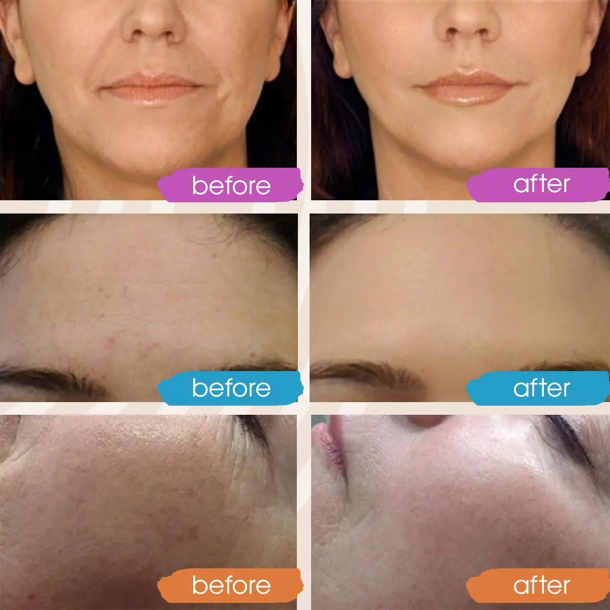 Vitamin C Serum Retinol Anti Aging for Face Sensitive Skin Women Mens Caffeine Yeast Rice Ginseng Private Label Anti Aging Serum