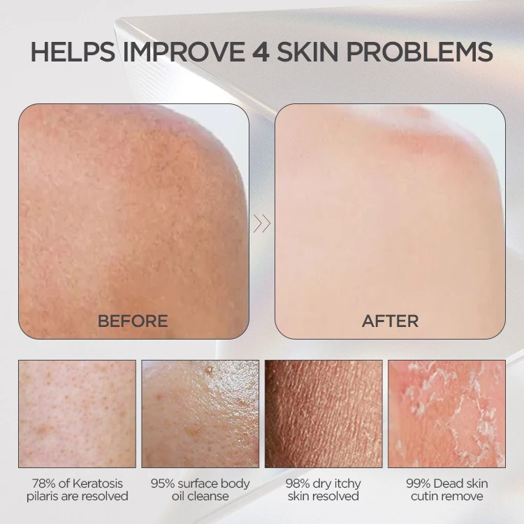 Silicone-free Viscose Dead Skin Remover Exfoliating Mitt Body Scrubber Gentle Exfoliating Glove For Softer & Smoother Skin Glow