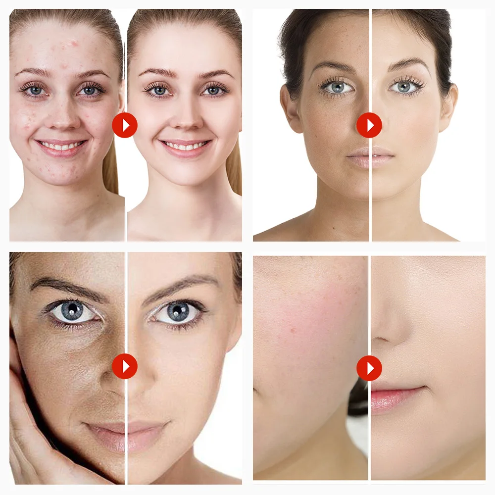 Factory Supply Cold Pressed 100% Pure Natural Organic Carrier Oil Grapeseed Oil In Bulk