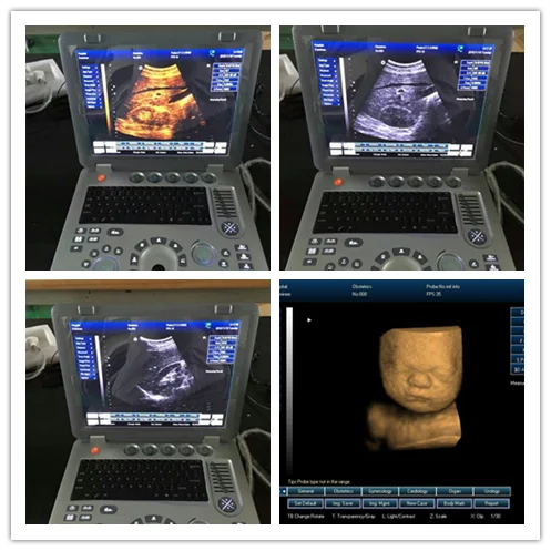 Конкурентоспособная цена 3D полностью цифровая ультразвуковая диагностическая система
