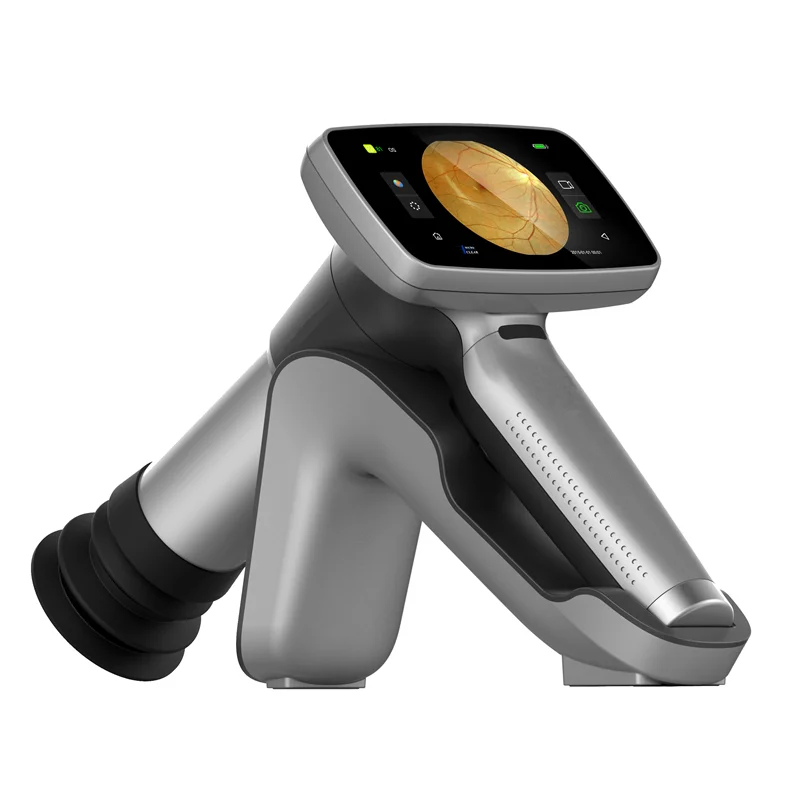 Hand-held Fundus Camera Digital Wifi Ophthalmoscope For Eye Fundus Inspection With 3.97 Inch Touch Screen