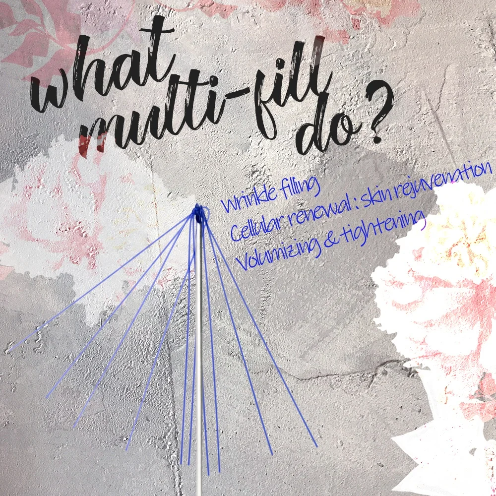 Korea Medical absorbable PDO Aphrodite Cavern Screw and Multi-Fill for Face Lifting Facial Rejuvenation Wrinkle Removal CE ISO