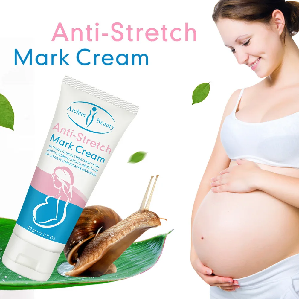 Hot sale Wholesale Natural Repairing Stretch Marks Removal Cream