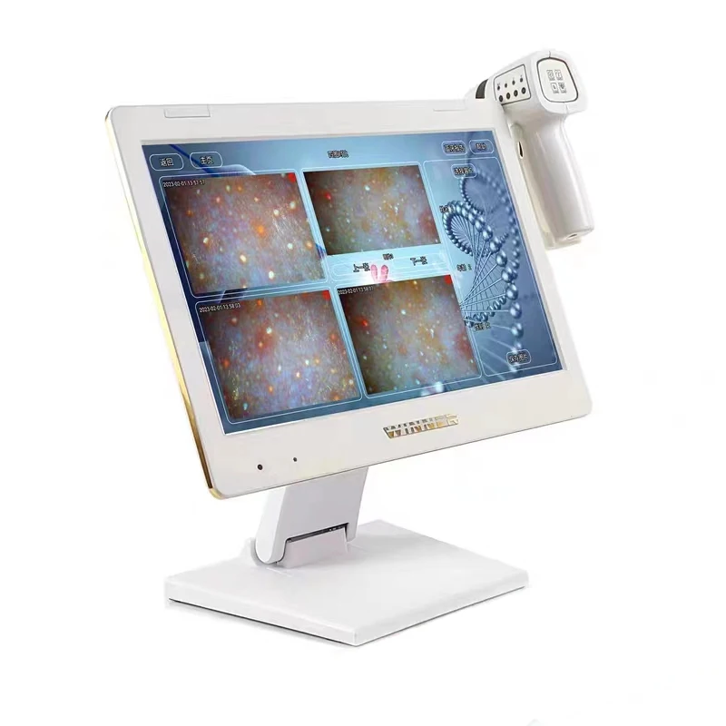 Wholesale of hair follicles and scalp scanning detectors by manufacturers Hair analyzer