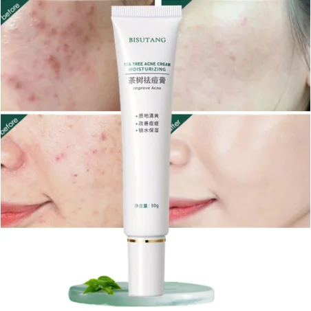 Herbal Acne Removal Face Cream Oil Control Anti-Acne Gel Treatment Acne Mark Skin Care Whitening Eliminate Pimples Facial Cream
