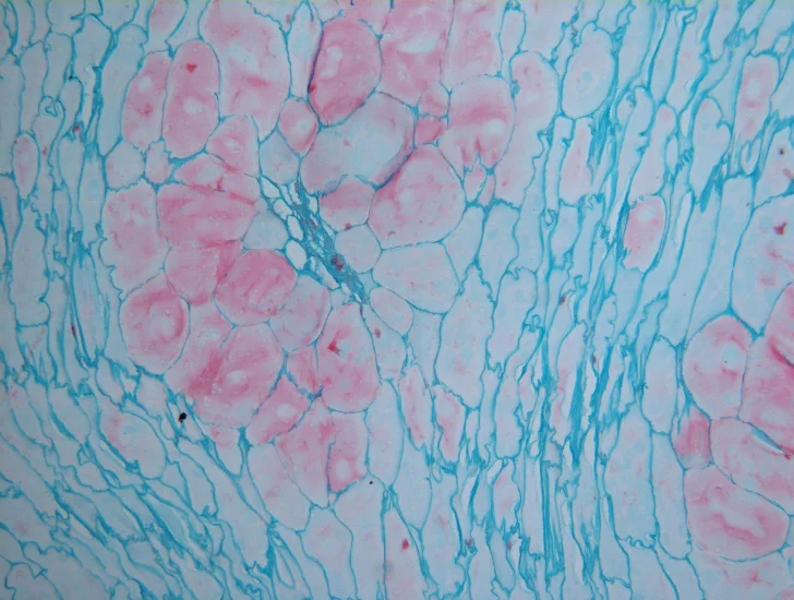 BestScope BS-2042T, классический лабораторный коллаж Infinity Koehler, студенческий тринокулярный биологический микроскоп