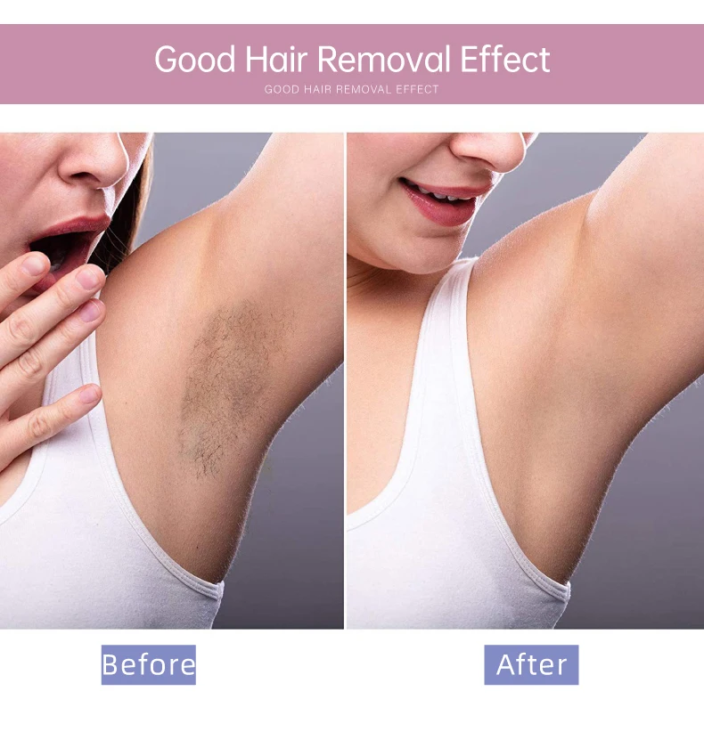 Hot selling soft Depilatory Paper Hair Removal Wax Strip Paper Depilatory Spunlace Waxing Roll nonwoven waxing rol