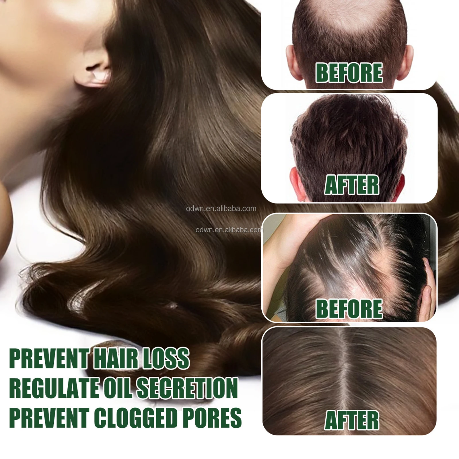 Otvena human hair care smooth promote hair growth reduce hair loss serum spray