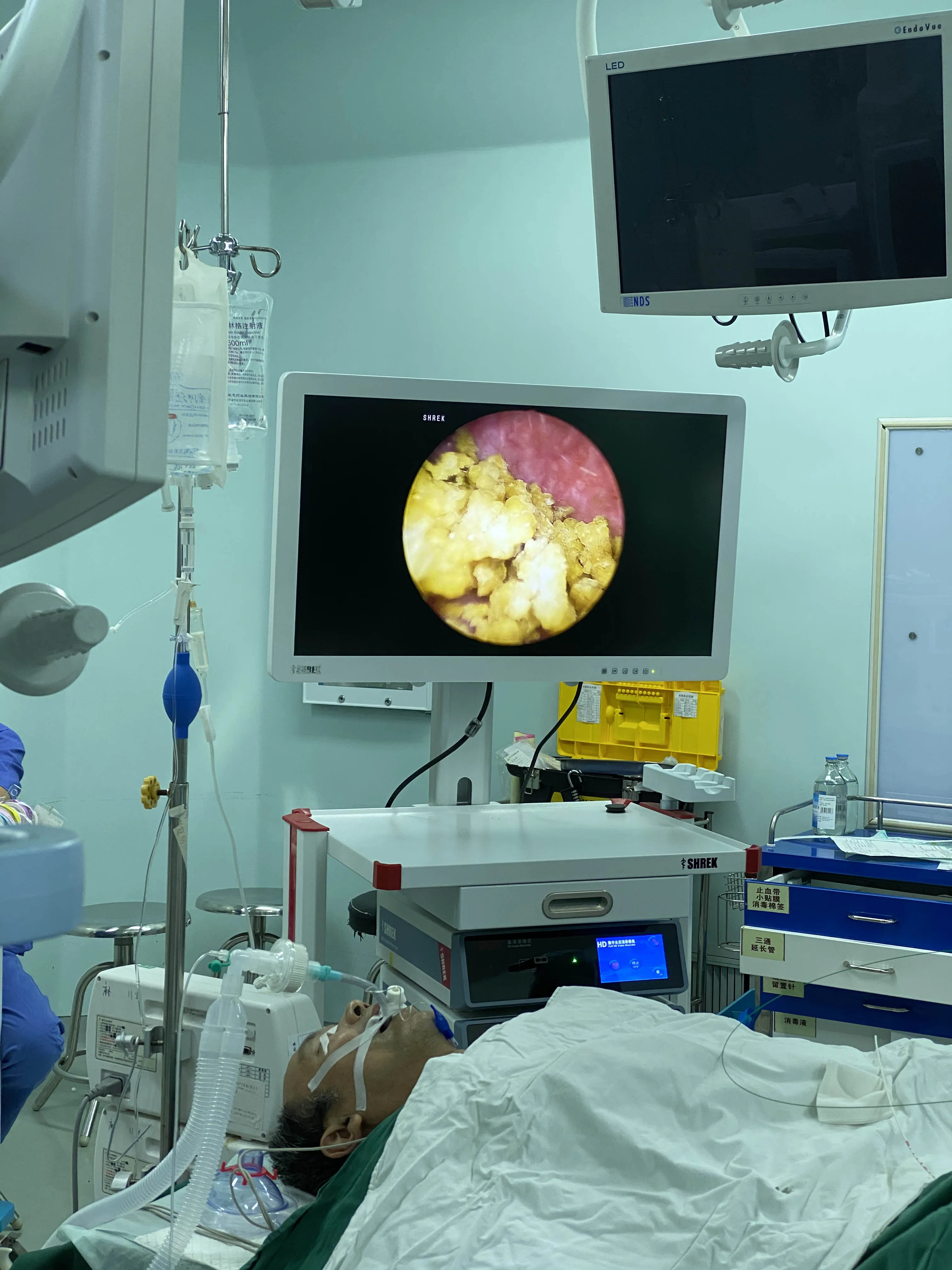 
High quality cheap 27 inch medical hd endoscopy monitor for laparoscopy 