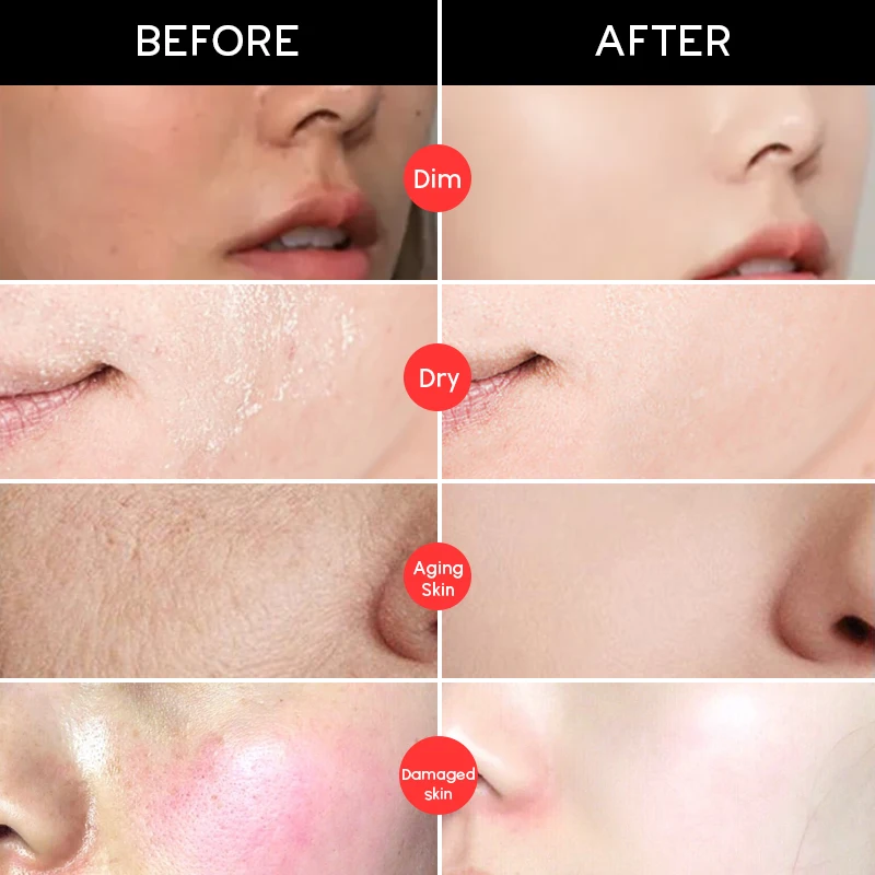 Private Label 6-Pcs Skin Care Set Includes Kojic Acid Whitening Lotion and Moisturizing Cream with Vitamin C Herbal Ingredients