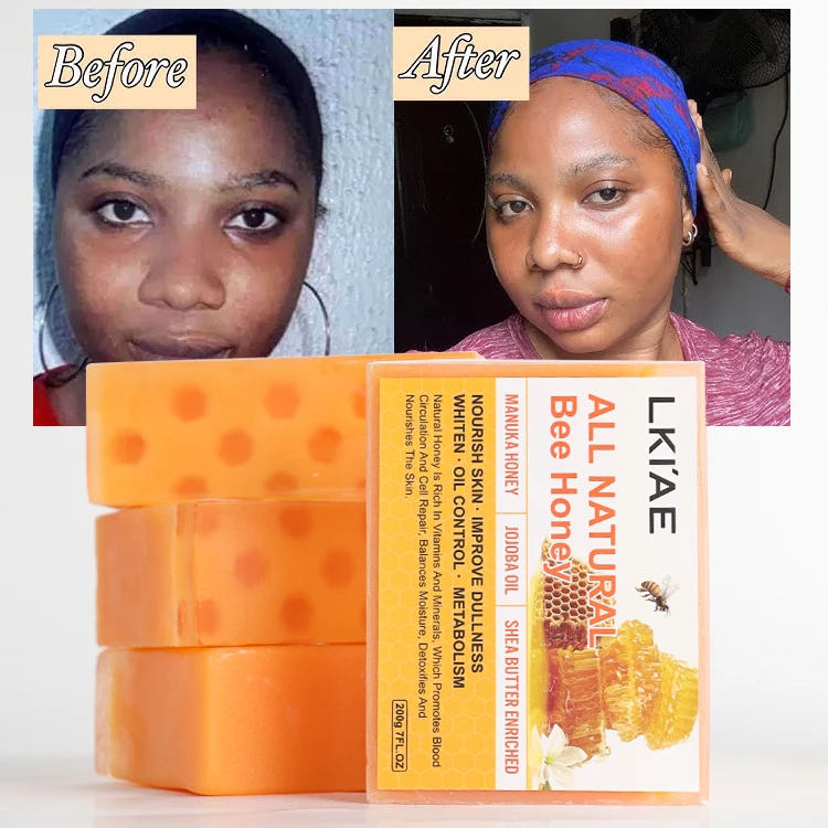Beauty 7 Days Whitening Manuka Honey Shea Butter Exfoliating Handmade Soap Toilet Bath Whitening Soap Home Use