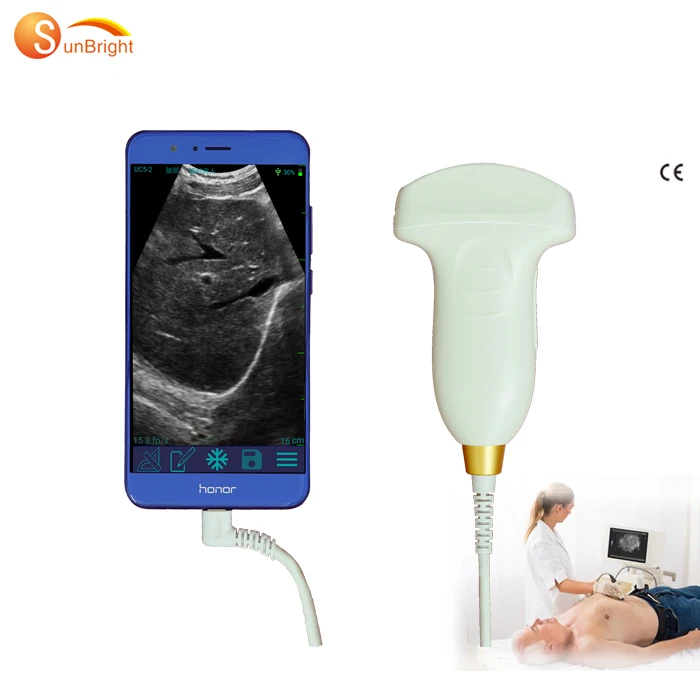 Wifi ultrasound USG wireless ultrasound probe type C connector IOS android mobile device