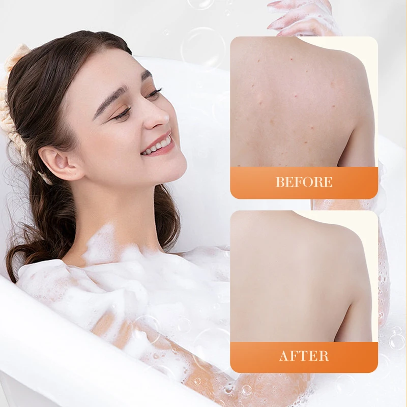 OEM SADOER Factory Price Organic Vegan Face Body Bar Soap Cleansing Remove Dark Spot Removal Turmeric Scrub Handmade Soap