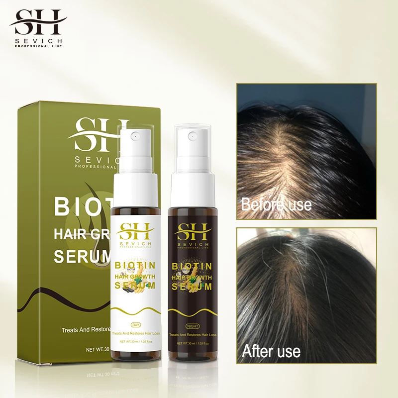 Hair Growth Lotion Customized Hair Growth Oil Manufacturer Biotin Collagen Hair Treatment Spray