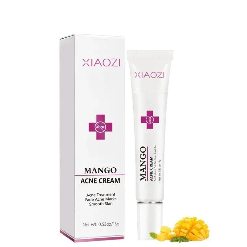 Repair Freckle  Acne Spot Remover Cream Oil Control Anti Acne Remove Dark Spot Face Cream Hot Selling