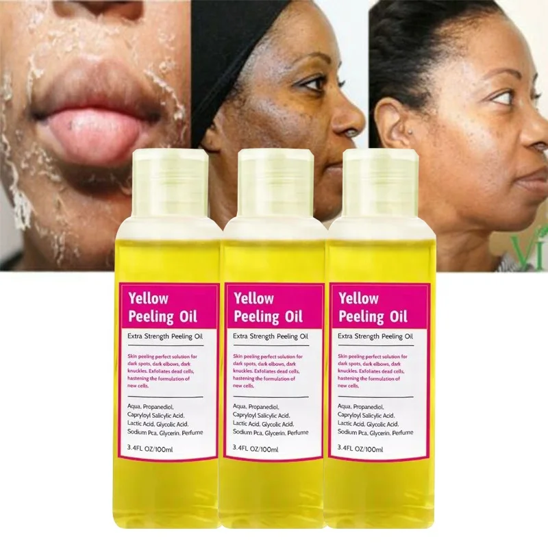 Wholesale 100ml Private Label Pure Natural Organic Body Oil Extra Strong Dark Knuckles Remove Dead Skin Yellow Peeling Oil