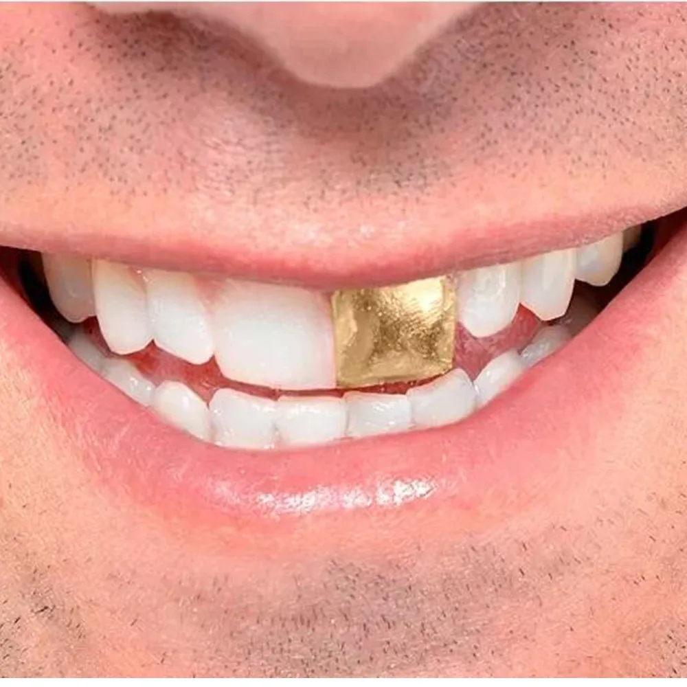 SowSmile Hip Hop Gold Grills Party Playing Snap on Dental Upper Lower False Teeth Cover Perfect Smile Veneers Dentures Equipment