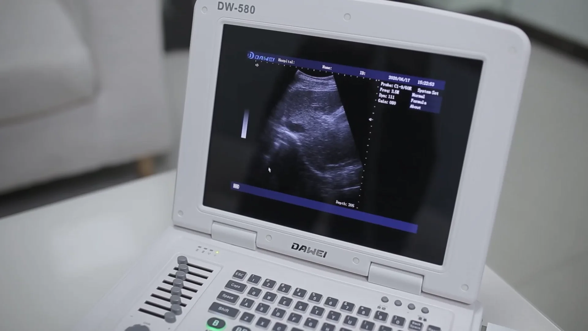laptop ultrasound scanner, portable ultrasound for pet hospital DW-VET3 (DW-500)