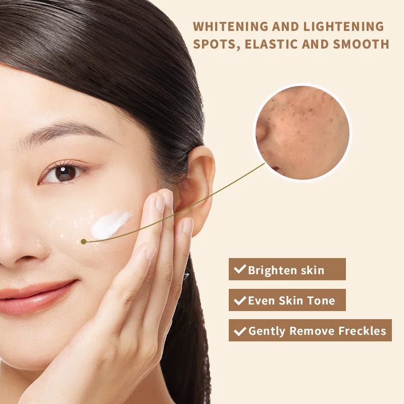 Cream for pimples  pimple remover  Shea Butter Vitamin E Salicylic Acid Carnosine Face Whitening Cream