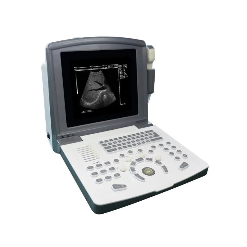 Full digital Manufacture CE Best price clinic Hospital  Portable Ultrasound Machine