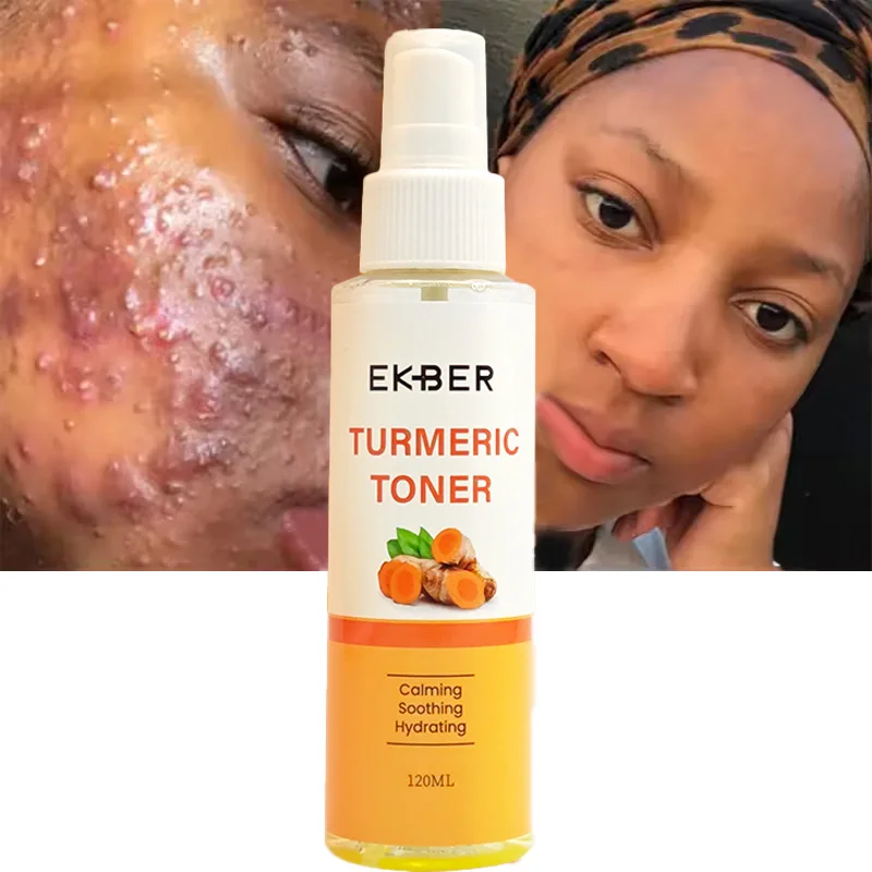 Private Label Organic Turmeric Facial Toner Fades Blemishes anti acne reduce swelling pain redness Face Turmeric Toner