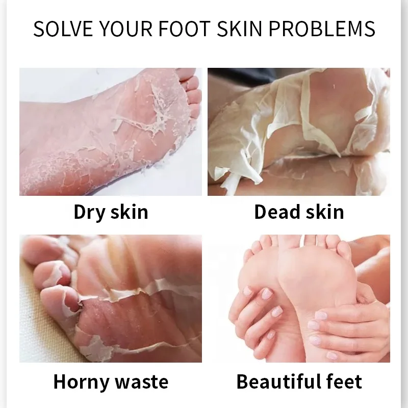 Private Label Vegan Natural Organic Remove Dead Skin Cuticles Heel Peeling Exfoliating Lavender Foot Mask