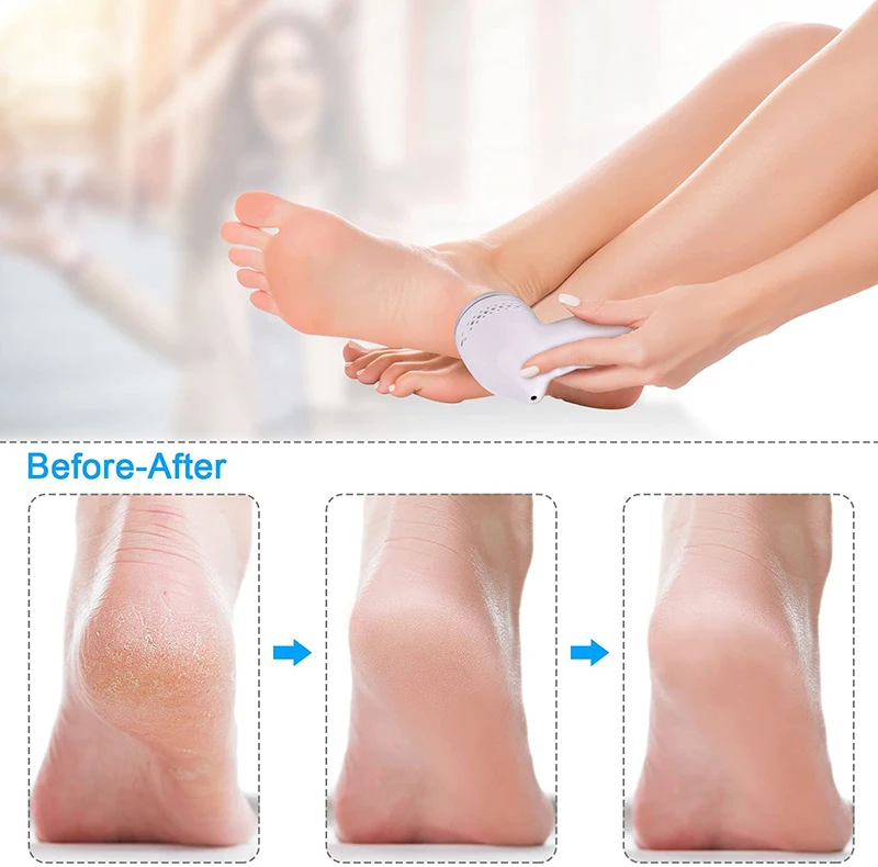 Professional rechargeable pedicure tool foot file electric callus remover with vacuum set