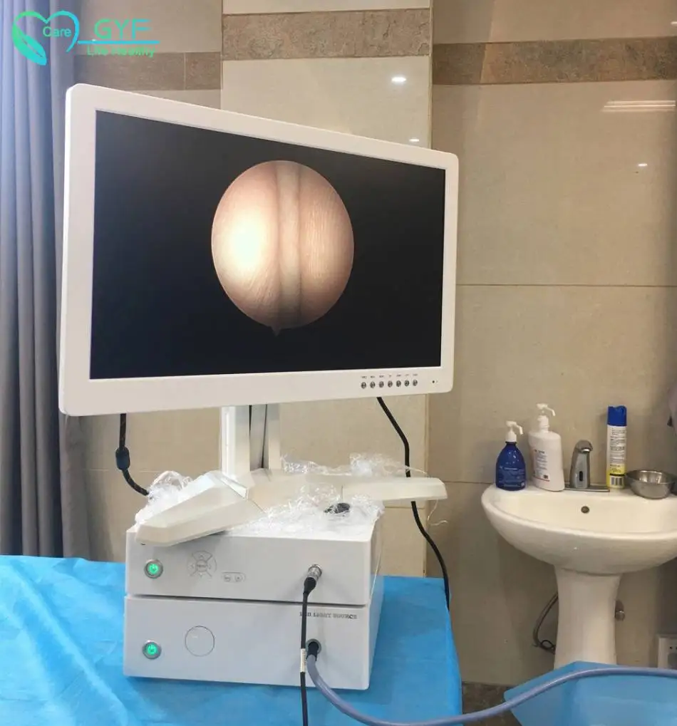 
21Fr x 231mm urological surgical instruments flexible cystoscope endoscope 